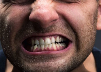 Gritting Teeth: 5 Signs You Shouldn’t Ignore